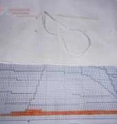 My new project